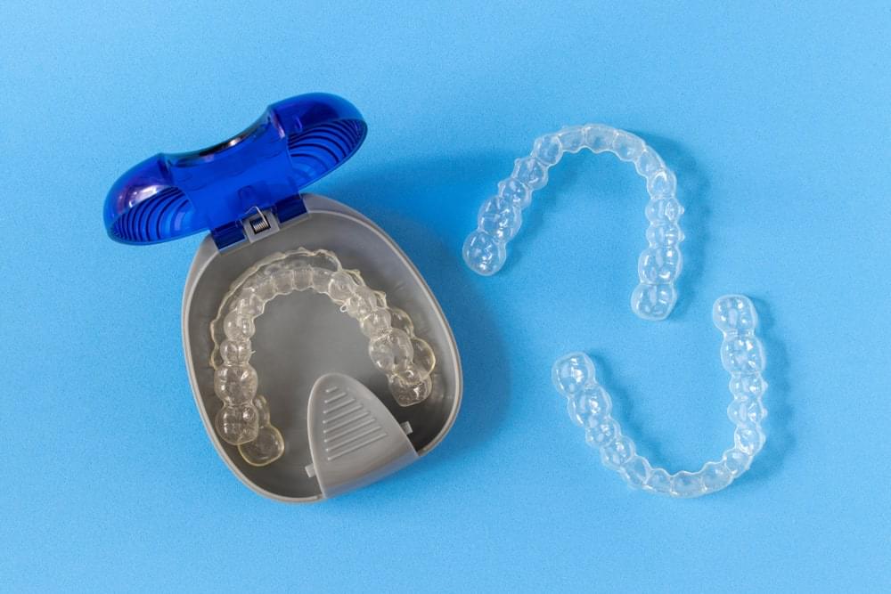 How to Clean Invisalign Aligners? | Lincoln Dental Center