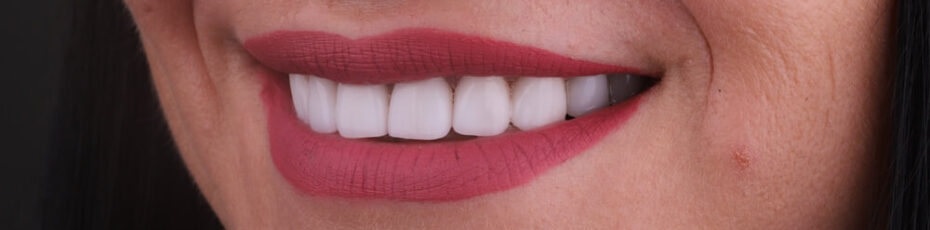 4 easy ways to completely transform your smile