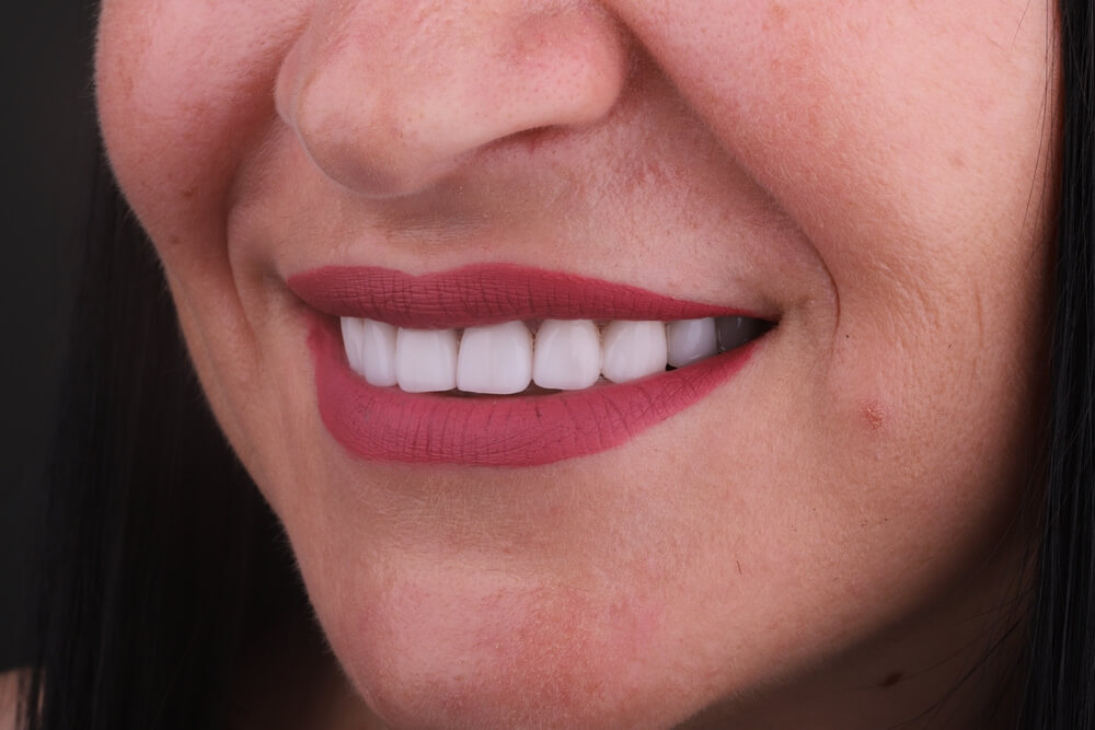 4 easy ways to completely transform your smile