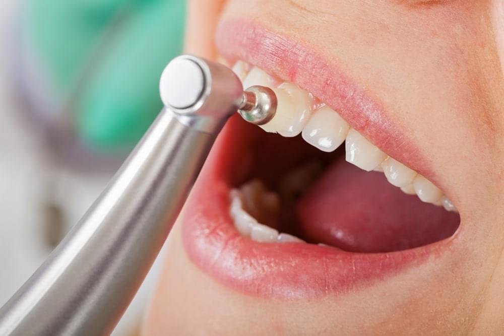 Does Professional Teeth Cleaning have any side effects?